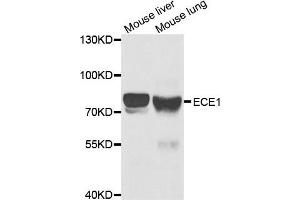 Western Blotting (WB) image for anti-Endothelin-Converting Enzyme 1 (ECE1) antibody (ABIN1876839) (ECE1 Antikörper)