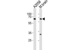 Western Blotting (WB) image for anti-Leucine Zipper, Putative Tumor Suppressor 1 (LZTS1) antibody (ABIN2997120) (LZTS1 Antikörper)
