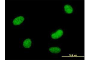 Immunofluorescence (IF) image for anti-SWI/SNF Related, Matrix Associated, Actin Dependent Regulator of Chromatin, Subfamily A-Like 1 (SMARCAL1) (AA 1-954) antibody (ABIN526298)