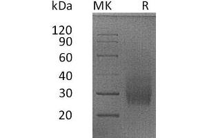 Western Blotting (WB) image for Tumor Necrosis Factor Receptor Superfamily, Member 14 (TNFRSF14) protein (His tag) (ABIN7320995) (HVEM Protein (His tag))