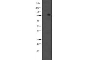 Western blot analysis of MCF2 expression in K562 cell line lysate ;,The lane on the left is treated with the antigen-specific peptide. (MCF2 Antikörper  (Internal Region))