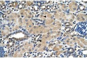 Immunohistochemical staining (Formalin-fixed paraffin-embedded sections) of human kidney with ASPH polyclonal antibody  at 4-8 ug/mL working concentration. (Aspartate beta Hydroxylase Antikörper  (N-Term))