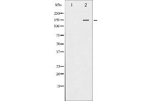 Western blot analysis of PLCG1 expression in EGF treated COS7 whole cell lysates,The lane on the left is treated with the antigen-specific peptide. (Phospholipase C gamma 1 Antikörper)
