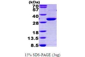 SDS-PAGE (SDS) image for Peroxisome Proliferator-Activated Receptor gamma (PPARG) (AA 209-477) protein (His tag) (ABIN667157) (PPARG Protein (AA 209-477) (His tag))