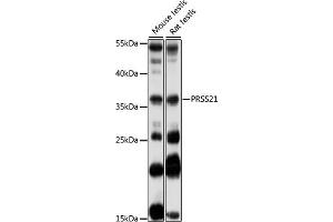 Western blot analysis of extracts of various cell lines, using PRSS21 antibody (ABIN7269581) at 1:1000 dilution. (PRSS21 Antikörper  (AA 150-220))