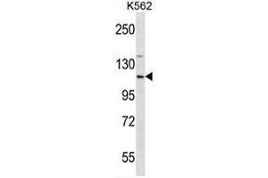 Western blot analysis using EIF3CL Antibody (N-term) Cat. (EIF3C Antikörper  (N-Term))