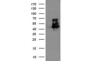 Western Blotting (WB) image for anti-ELK3, ETS-Domain Protein (SRF Accessory Protein 2) (ELK3) antibody (ABIN1498007) (ELK3 Antikörper)