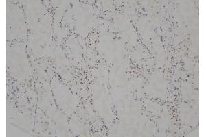 ABIN6268828 at 1/100 staining Human lung tissue by IHC-P.