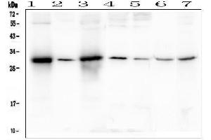 Western blot analysis of SOX15 using anti-SOX15 antibody (ABIN6719624).