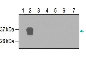 Western blot was performed on seven GST-fusion proteins containing different fragments of RUNX1T1 (Lane 1~7).