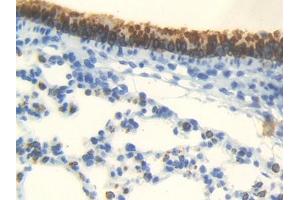 IHC-P analysis of Mouse Lung Tissue, with DAB staining. (Androgen Receptor Antikörper  (AA 156-310))