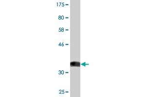 Western Blotting (WB) image for anti-Activin Receptor Type I (ACRV1) (AA 21-120) antibody (ABIN513099)