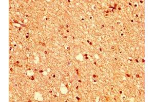 IHC image of ABIN7151835 diluted at 1:400 and staining in paraffin-embedded human brain tissue performed on a Leica BondTM system. (EPH Receptor A2 Antikörper  (AA 627-976))