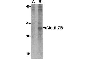 Western Blotting (WB) image for anti-Methyltransferase Like 7B (METTL7B) (N-Term) antibody (ABIN1031456) (METTL7B Antikörper  (N-Term))