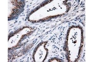 Immunohistochemistry (IHC) image for anti-Induced Myeloid Leukemia Cell Differentiation Protein Mcl-1 (MCL1) antibody (ABIN1499340) (MCL-1 Antikörper)