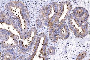 IHC analysis of HGS using anti-HGS antibody (ABIN7601207).