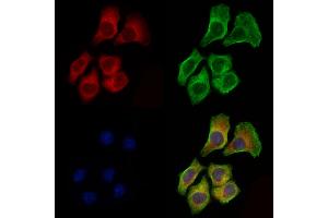 ABIN7094430 and ABIN7098478 staining Hela cells by IF/ICC.