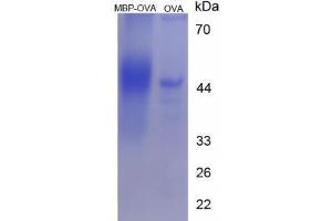 Image no. 1 for Myelin Basic Protein (MBP) peptide (Ovalbumin) (ABIN5666278) (Myelin Basic Protein (MBP) peptide (Ovalbumin))