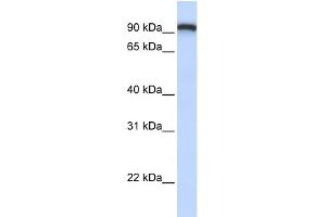 WB Suggested Anti-TMEM168 Antibody Titration:  0. (TMEM168 Antikörper  (C-Term))