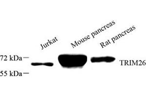 Western blot analysis of TRIM26 (ABIN7076014) at dilution of 1: 1500 (TRIM26 Antikörper)