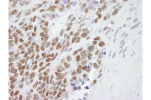 Immunohistochemistry (IHC) image for anti-Chromobox Homolog 3 (CBX3) (C-Term) antibody (ABIN7448460)