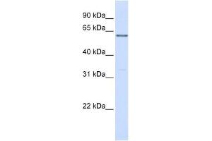 PPP2R3B antibody used at 1 ug/ml to detect target protein. (PPP2R3B Antikörper)