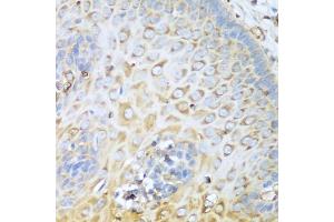 Immunohistochemistry of paraffin-embedded human esophagus using MYH9 antibody. (Myosin 9 Antikörper)