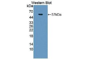 Western blot analysis of the recombinant protein. (NUP50 Antikörper  (AA 179-428))
