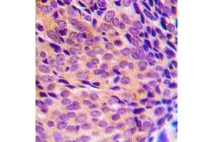 Immunohistochemistry (IHC) image for anti-Nuclear Factor of kappa Light Polypeptide Gene Enhancer in B-Cells 1 (NFKB1) (pSer337) antibody (ABIN7296416)