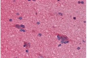 Human Brain, Cortex (formalin-fixed, paraffin-embedded) stained with SNCA antibody ABIN364317 at 10 ug/ml followed by biotinylated anti-mouse IgG secondary antibody ABIN481714, alkaline phosphatase-streptavidin and chromogen.