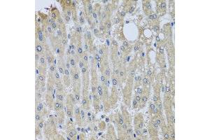 Immunohistochemistry of paraffin-embedded human liver injury using SYT11 antibody at dilution of 1:100 (x40 lens).