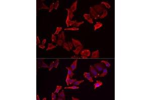 Immunofluorescence analysis of MCF7 cells using SKAP2 Polyclonal Antibody (SKAP2 Antikörper)