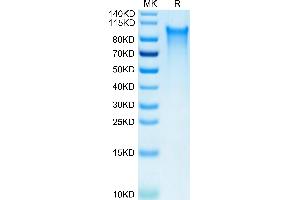 Human CX3CL1 on Tris-Bis PAGE under reduced condition. (CX3CL1 Protein (AA 25-341) (His tag))