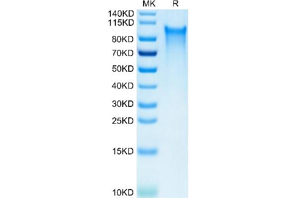 CX3CL1 Protein (AA 25-341) (His tag)