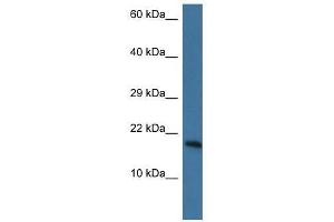 Western Blot showing Pnkd antibody used at a concentration of 1. (PNKD Antikörper  (N-Term))
