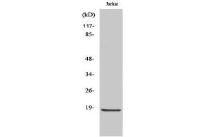 Western Blotting (WB) image for anti-Caspase 2 p18 (Cleaved-Gly170) antibody (ABIN5955971) (Caspase 2 p18 Antikörper  (Cleaved-Gly170))
