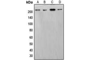 Western blot analysis of BRM expression in HepG2 (A), HeLa (B), THP1 (C), NIH3T3 (D) whole cell lysates. (SMARCA2 Antikörper  (Center))