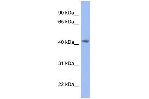 PRPSAP2 antibody used at 1 ug/ml to detect target protein. (PRPSAP2 Antikörper  (N-Term))