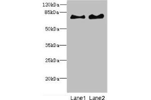 Western blot All lanes: INTS10 antibody at 4. (INTS1 Antikörper  (AA 451-710))