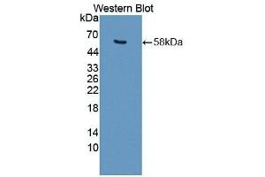 Detection of Recombinant PCSK9, Mouse using Polyclonal Antibody to Proprotein Convertase Subtilisin/Kexin Type 9 (PCSK9) (PCSK9 Antikörper  (AA 164-428))