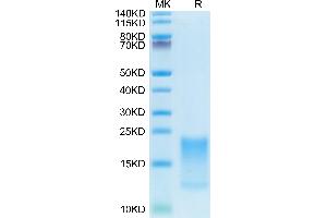 SDS-PAGE (SDS) image for Tumor Necrosis Factor Receptor Superfamily, Member 13C (TNFRSF13C) (AA 7-71) protein (His tag) (ABIN7273907)