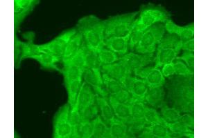 Immunocytochemistry/Immunofluorescence analysis using Mouse Anti-Nav1. (Nav1.8 Antikörper  (AA 1724-1956) (PerCP))