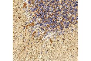 IHC analysis of PAK3 using anti-PAK3 antibody (ABIN7599182). (PAK3 Antikörper  (AA 1-263))