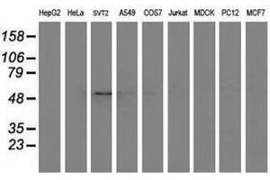 Image no. 3 for anti-Adaptor-Related Protein Complex 2, mu 1 Subunit (AP2M1) (AA 97-383) antibody (ABIN1491721)