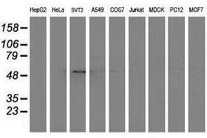 Image no. 3 for anti-Adaptor-Related Protein Complex 2, mu 1 Subunit (AP2M1) (AA 97-383) antibody (ABIN1491721) (AP2M1 Antikörper  (AA 97-383))