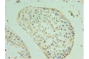 Immunohistochemistry of paraffin-embedded human testis tissue using ABIN7170476 at dilution of 1:100 (SPAG16 Antikörper  (AA 1-183))
