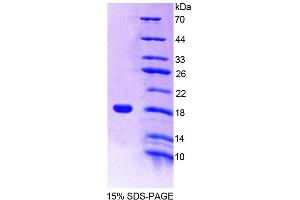 Image no. 1 for CD7 (CD7) (AA 24-150) protein (T7 tag,His tag) (ABIN6238918) (CD7 Protein (CD7) (AA 24-150) (T7 tag,His tag))