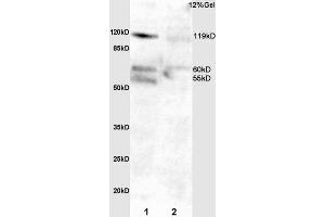 L1 mouse intestine lysate L2 rat lung lysates probed with Anti Phospho-FAK (Tyr397)Polyclonal Antibody, Unconjugated  at 1:3000 for 90 min at 37˚C. (FAK Antikörper  (pTyr397))