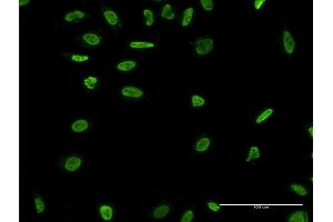 Immunofluorescence of monoclonal antibody to RAD18 on HeLa cell. (RAD18 Antikörper  (AA 332-430))