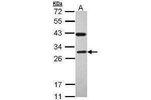 WB Image Sample (30 ug of whole cell lysate) A: H1299 12% SDS PAGE antibody diluted at 1:1000 (Rab3c Antikörper)
